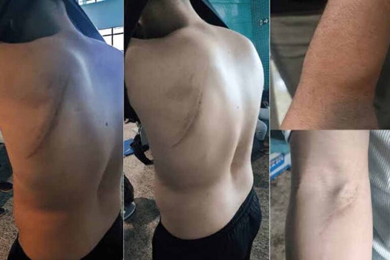 Advogado de Rondônia expõe denúncias sobre condições degradantes de deportação de brasileiros
