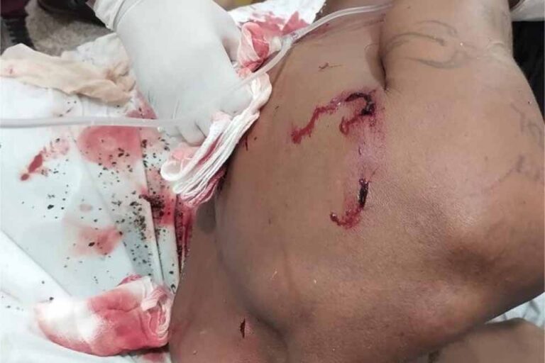 Polícia Militar registra tentativa de homicídio com faca e vítima sofre cinco perfurações em Pimenta Bueno