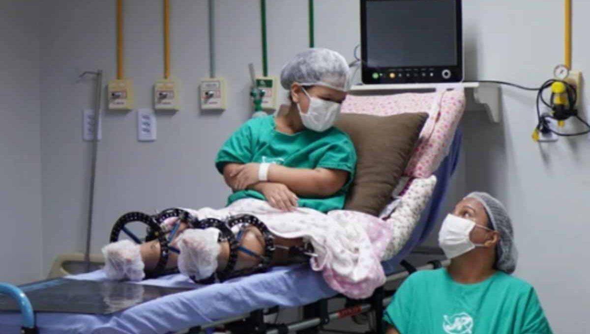 Cirurgia inédita de alongamento ósseo para nanismo é realizada pelo SUS em Rondônia