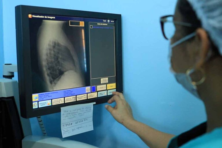 Porto Velho intensifica ações de conscientização sobre tuberculose e alerta para abandono de tratamento