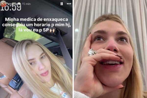 Virginia Fonseca relata nova crise de enxaqueca após atraso em tratamento com botox antes do Carnaval