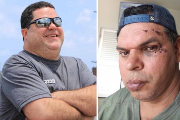 Acidente com cadeirante expõe falhas em acessibilidade e reforça denúncias sobre calçadas em Ariquemes