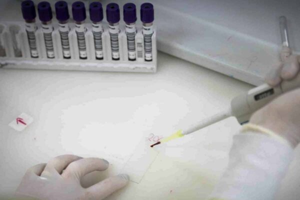 Paciente isolado em São Paulo testa positivo para meningite enquanto suspeita de ebola segue sob investigação