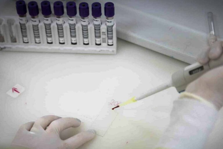 Paciente isolado em São Paulo testa positivo para meningite enquanto suspeita de ebola segue sob investigação