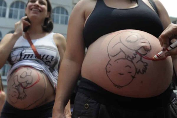 Fatores sociais e estruturais influenciam alta taxa de cesarianas no Brasil, aponta pesquisa do Unicef