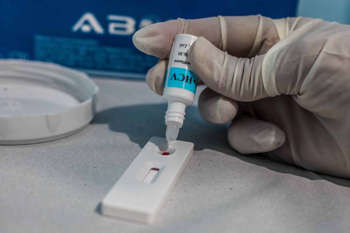 Porto Velho reforça testagem contra hepatites virais e registra 215 casos de hepatite B em 2025