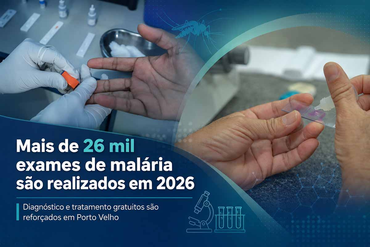 Porto Velho reforça diagnóstico de malária após aumento de casos em 2026